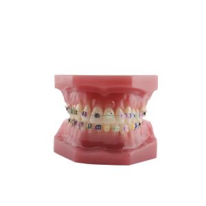 bracket Bader – 0905102